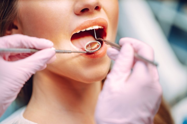 woman opening her mouth for a dentist while they use dental instruments to probe around in her mouth